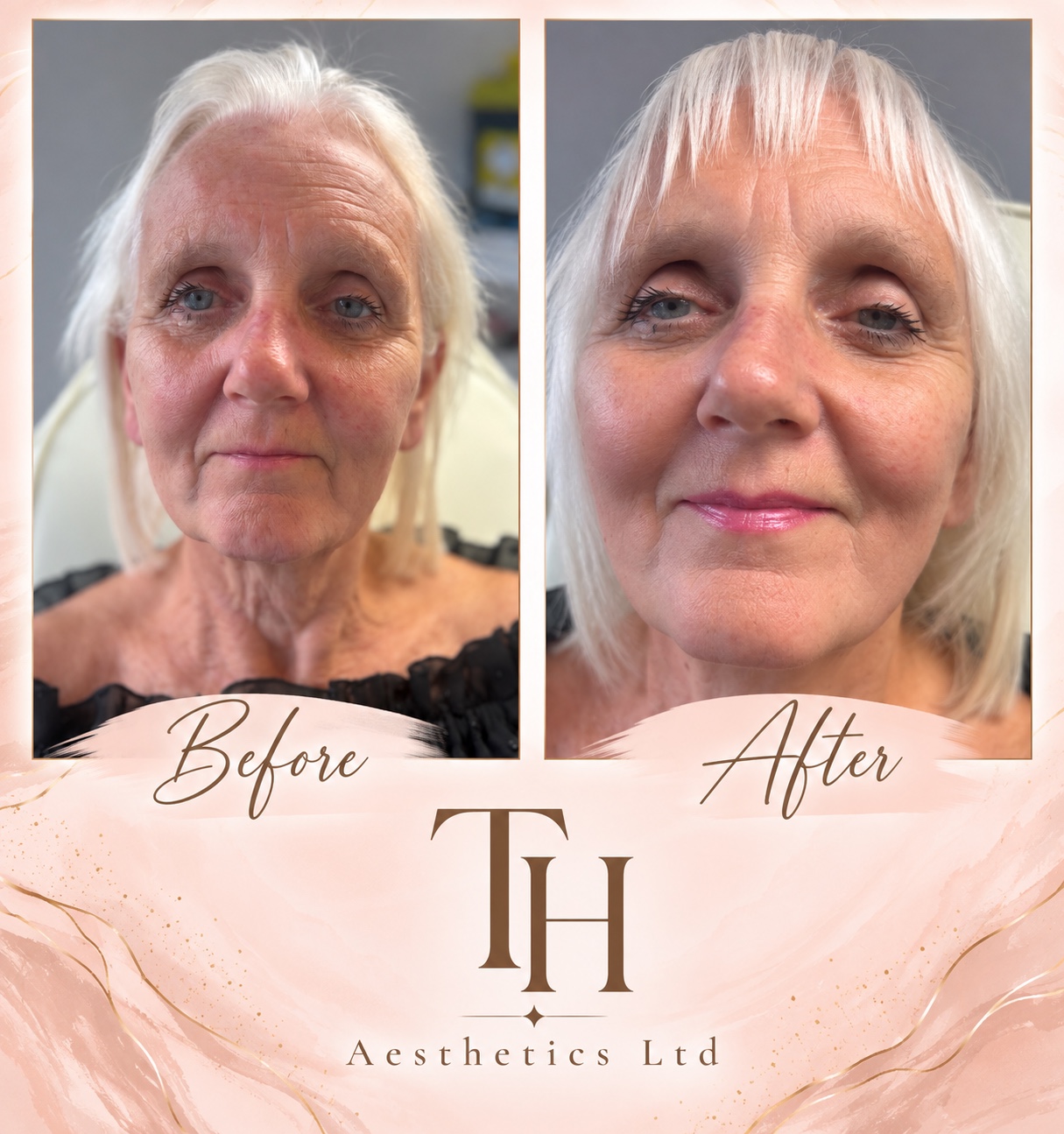 Client treatment comparison supplied for review